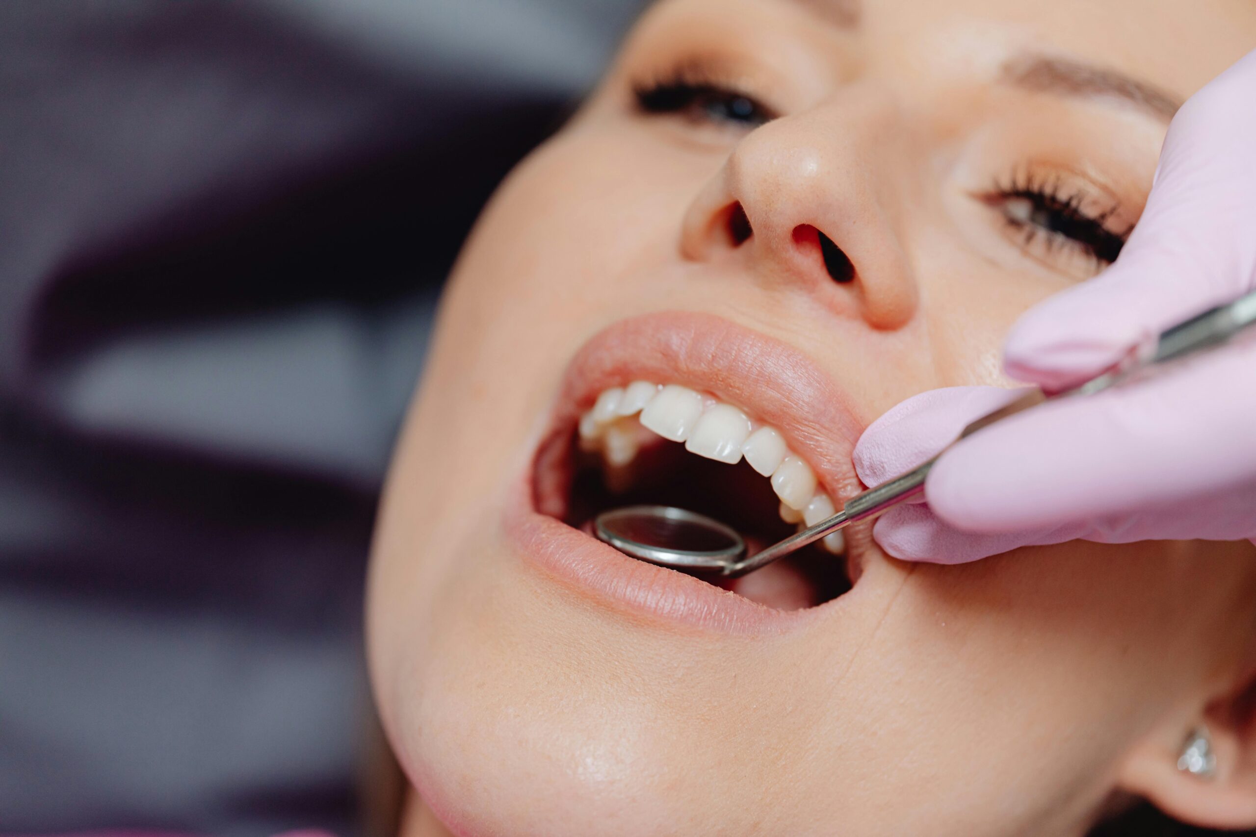 Periodoncia en Madrid.